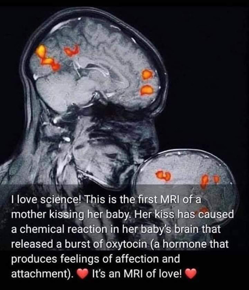Η εικόνα MRI με το φιλί της μαμάς στο μωρό της που έγινε viral